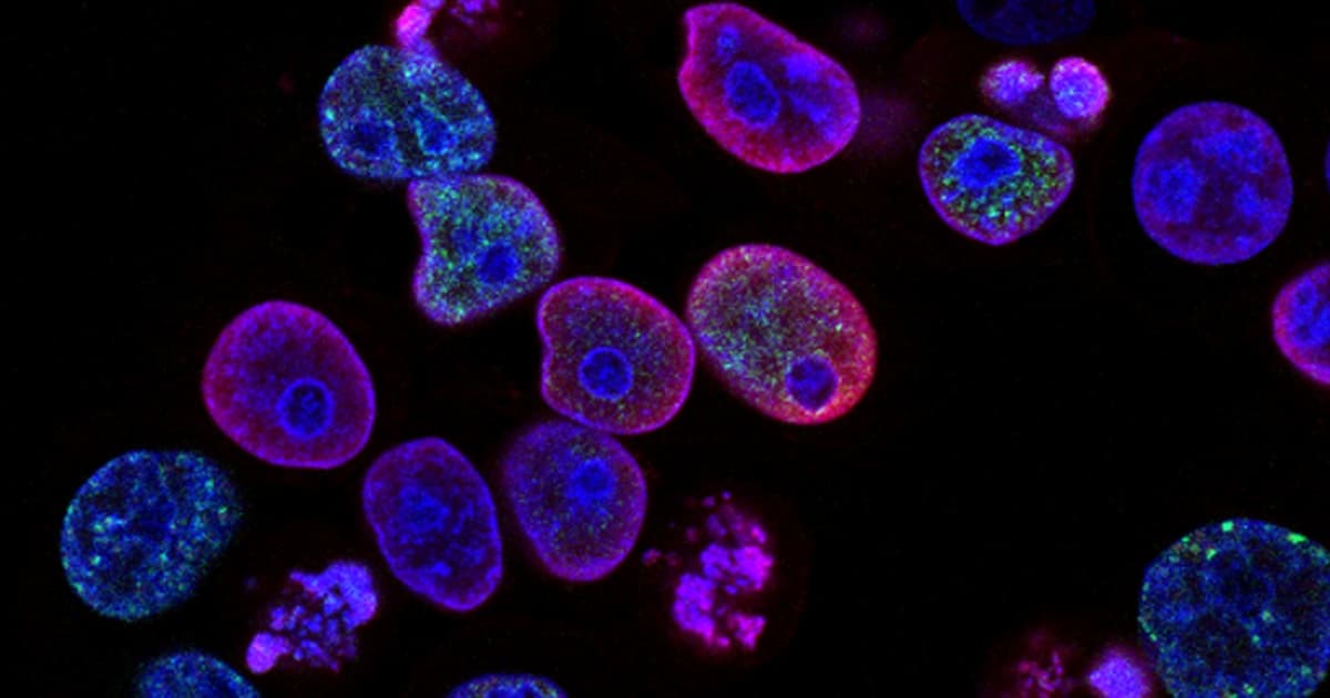 Ipamorelin + CJC-1295 Stack — Benefits, Protocol & How GH Peptides Work